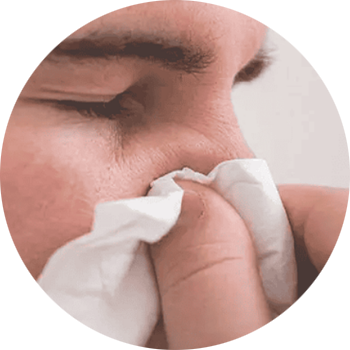 Vách ngăn mũi bị lệch